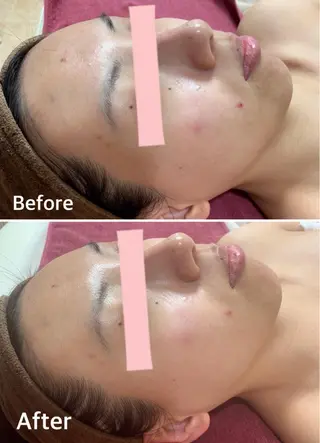 レイビス盛岡店 ♡吉田♡のエステ・リラクイメージ