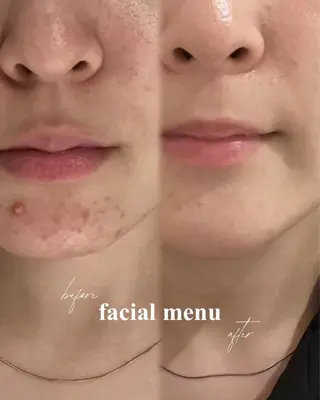 Linoa skin salon所属・Linoa 大名のエステ・リラクイメージ