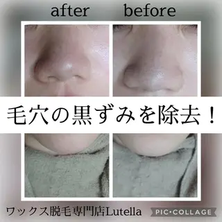 Lutella所属・ワックス脱毛専門店 Lutellaのエステ・リラクイメージ