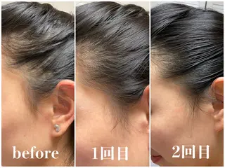 毛穴レス ハーブ＆ ワックス脱毛×光脱毛のエステ・リラクイメージ