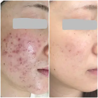 エステティックサロン ベルネのエステ・リラクイメージ