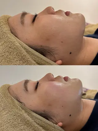 メンズ 腸活サポート みなみののエステ・リラクイメージ