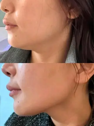 ネイル aliaハイフ&水光ジェットサロン所属・aliaハーブ水光店 エステティシャン募集のエステ・リラクイメージ