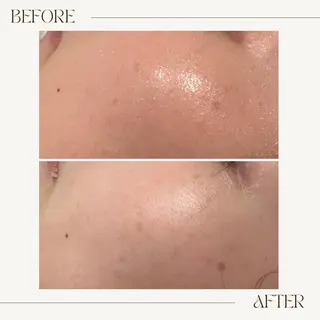 GranDir所属・GranDir 堀井美沙のエステ・リラクイメージ