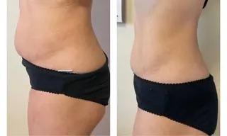 毛穴改善/脱毛 ネイル　川上久仁子のエステ・リラクイメージ