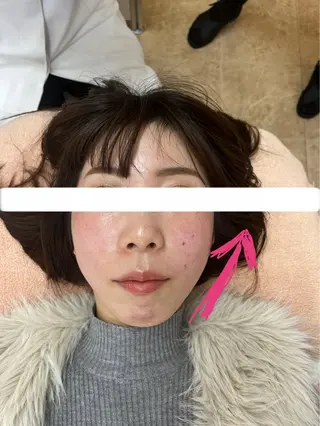 こりとりコルギ専門店 MIICO(ミイコ)所属・西村 みさきのエステ・リラクイメージ