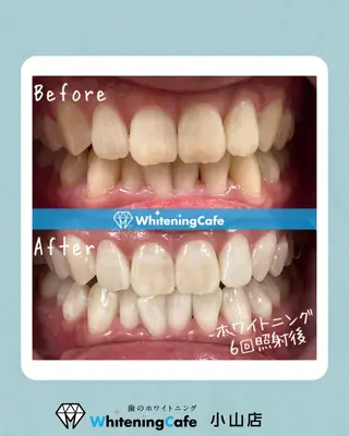 ホワイトニングカフェ 小山店のエステ・リラクイメージ