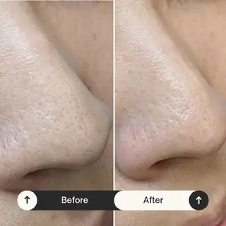 CARO(カーロ）所属・まつ毛とお肌のサロン AKO/吹田駅のマツエク・マツパデザイン