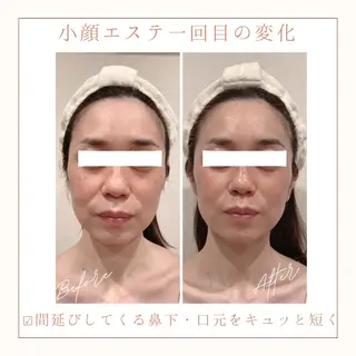 小顔×肌質改善サロン soin〔ソワン〕のエステ・リラクイメージ