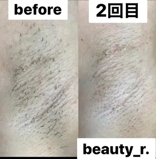 杉原 里奈のエステ・リラクイメージ