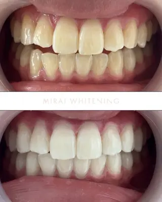 MIRAI WHITENING所属・ミライ ホワイトニングのエステ・リラクイメージ
