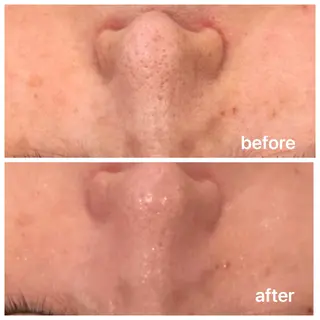 トータルビューティ サロンstageのエステ・リラクイメージ