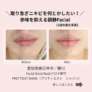 PRETTIEST SHINE所属・山田 浩子のエステ・リラクイメージ