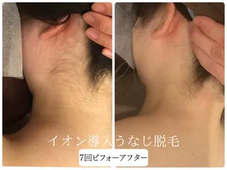 Beauty salon Lino所属・🎀うなじ脱毛🎀 ㅣLino堀江のエステ・リラクイメージ