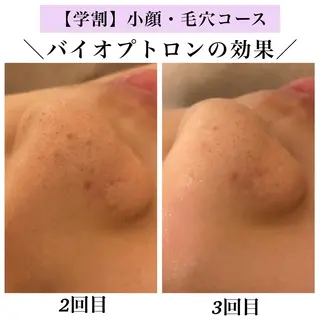 Bellesthe （ベルエステ）のエステ・リラクイメージ