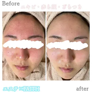 ショート カラー パーマ ヘアアレンジ メンズ キッズ ネイル マツエク・マツパ アイブロウ ニキビ&跡改善サロン オーナー光木のエステ・リラクイメージ