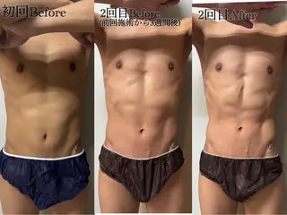 六本木脱毛andS さおりのエステ・リラクイメージ