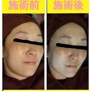 viage所属・viage 脱毛&フェイシャル店のエステ・リラクイメージ