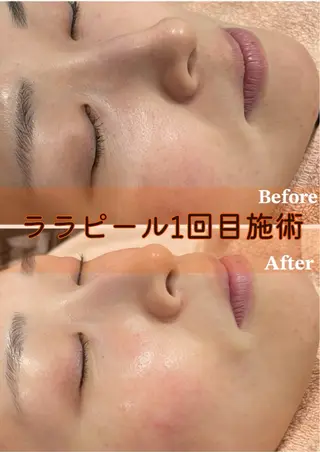 徳山 まみのエステ・リラクイメージ