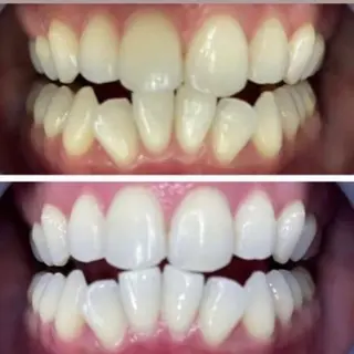 LOVE ホワイトニング新宿店のエステ・リラクイメージ