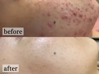 フェイシャル/脱毛 ジョアアンジェ竹田のエステ・リラクイメージ