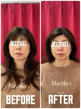 小顔・美肌専門店 天六徒歩1分のその他イメージ