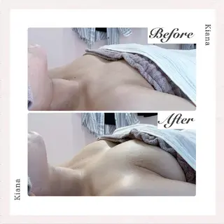 【バスト専門店 】 Kiana のエステ・リラクイメージ