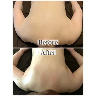 mooi【モーイ】所属・【北堀江】 痩身/小顔　mooiのエステ・リラクイメージ