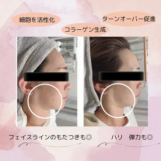 esthesalon Ran所属・小顔美肌痩身サロン Ranのその他イメージ