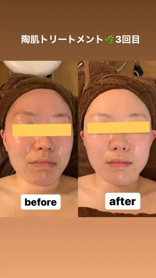 プライベートサロンsoleil所属・プライベートサロン soleilのエステ・リラクイメージ