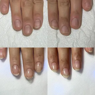 ネイル 自爪育成・巻き爪 補正講師　津蔵のネイルデザイン