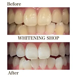 ホワイトニング ショップ川越店のエステ・リラクイメージ