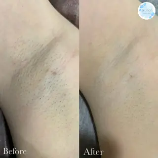 美容鍼脱毛salon リノン吹田駅前店のエステ・リラクイメージ