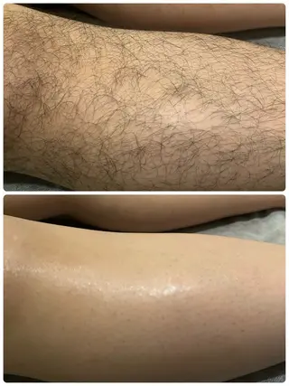 メンズ Chainon Beautyのエステ・リラクイメージ