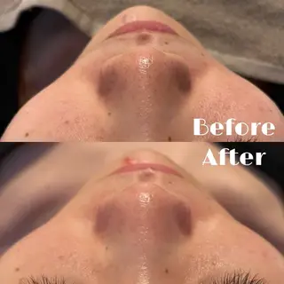 美容革命ラボ福岡春吉店所属・美容革命ラボ 福岡のエステ・リラクイメージ