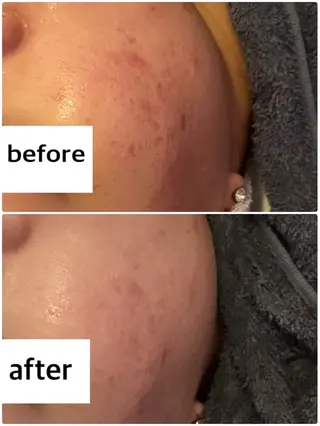 Belle原宿所属・佐藤 加奈のエステ・リラクイメージ