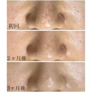 毛穴ケア専門サロンアンスリウム所属・茨城土浦 つくば毛穴 ケア専門サロンのエステ・リラクイメージ