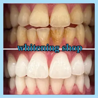 ホワイトニング ショップ千葉店のその他イメージ