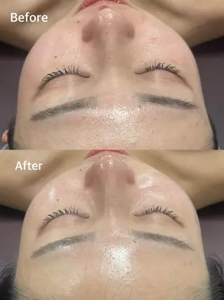 小顔専門看護師クリニカルサロンCOCO所属・小顔と美肌サロン クリニカルサロンココのエステ・リラクイメージ