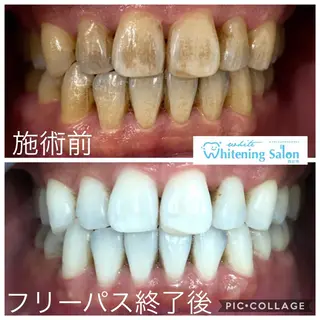 ホワイトニング&アイラッシュ四日市ホワイト所属・アイラッシュ ホワイトニング四日市のマツエク・マツパデザイン