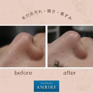 ANRIRE (アンリール)のエステ・リラクイメージ