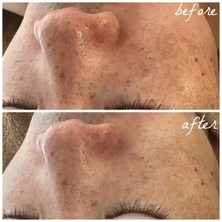 メンズ メナード岐阜市茜部 杉浦のエステ・リラクイメージ