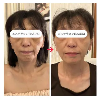 たるみ改善小顔エステ 堀葉月のその他イメージ