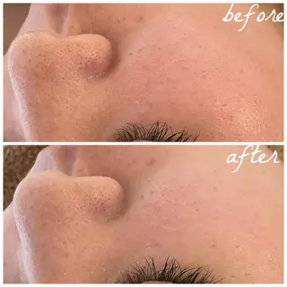 メンズ メナード岐阜市茜部 杉浦のエステ・リラクイメージ