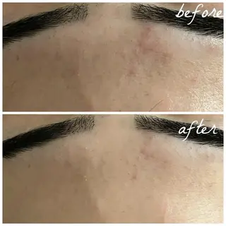 メンズ メナード岐阜茜部 杉浦のエステ・リラクイメージ