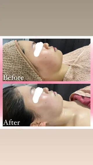 salon〜RePCa〜(サロンルピカ)所属・山﨑 藍のエステ・リラクイメージ