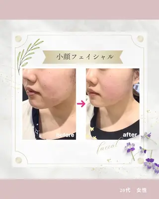 《 肌質×美肌 》 addissimoのエステ・リラクイメージ