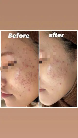 ショート カラー パーマ ヘアアレンジ メンズ キッズ ネイル マツエク・マツパ アイブロウ Amaryllis 🌹のエステ・リラクイメージ