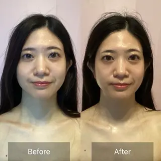 美肌エイジングケアサロンIB所属・ＩＢ 内藤のエステ・リラクイメージ