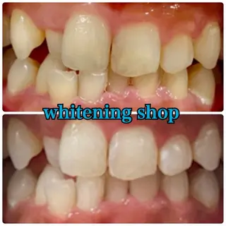 メンズ ホワイトニング ショップ川越店のエステ・リラクイメージ